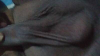 sri lankan very ugly fat boy showing phymo cock and fuckhole - boyfriendtv.com